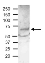 BG1 | Beta-glucosidase 1 in the group Antibodies Plant/Algal / Membrane Transport System / Endomembrane system at Agrisera AB (Antibodies for research) (AS20 4419)